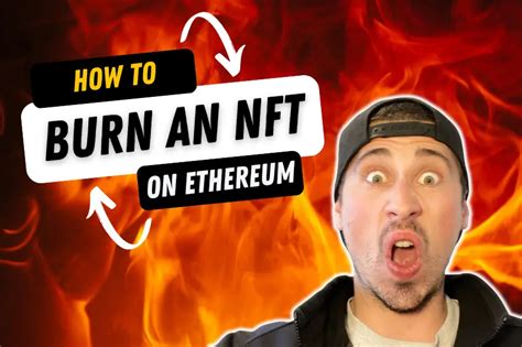 how to burn an nft